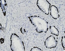 Tissue-Tek Genie<sup>&reg;</sup><br />
anti-Cytokeratin 14