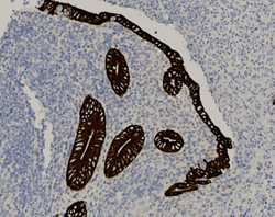 Tissue-Tek Genie<sup>&reg;</sup><br />
anti-Cytokeratin 8