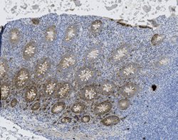 Tissue-Tek Genie<sup>&reg;</sup><br />
anti-CD138