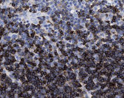 Tissue-Tek Genie<sup>&reg;</sup><br />
anti-CD1a