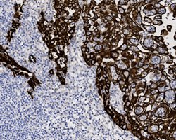 Tissue-Tek Genie<sup>&reg;</sup><br />
anti-Cytokeratin HMW (CK5)