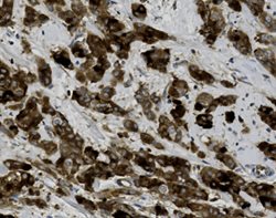 Tissue-Tek Genie<sup>&reg;</sup><br />
anti-GCDFP-15