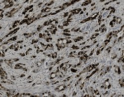 Tissue-Tek Genie<sup>&reg;</sup><br />
anti-Mammaglobin