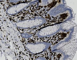 Tissue-Tek Genie<sup>&reg;</sup><br />
anti-CD163