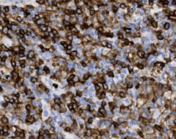 Tissue-Tek Genie<sup>&reg;</sup><br />
anti-CD4