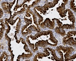 Tissue-Tek Genie<sup>&reg;</sup><br />
anti-Cytokeratin 7