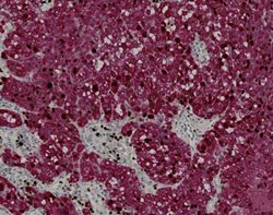 Tissue-Tek Genie<sup>&reg;</sup> DUO<br />
anti-Melan-A / Ki67 Antibody Cocktail