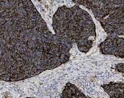 Tissue-Tek Genie<sup>&reg;</sup><br />
anti-Cytokeratin Antibody Cocktail [AE1/AE3]