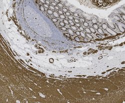 Tissue-Tek Genie<sup>&reg;</sup><br />
anti-Actin, Smooth Muscle