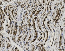 Tissue-Tek Genie<sup>&reg;</sup><br />
anti-Neurofilament