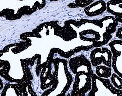 Tissue-Tek Genie<sup>&reg;</sup><br />
anti-Cytokeratin Pan Antibody Cocktail [AE1/AE3/DC10]