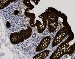 Tissue-Tek Genie<sup>&reg;</sup><br />
anti-Cytokeratin LMW (CK8/18) Antibody Cocktail [EP17/DC10]