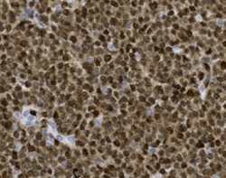 Tissue-Tek Genie<sup>&reg;</sup><br />
anti-MUM-1