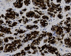 Tissue-Tek Genie<sup>&reg;</sup><br />
anti-Prostate Specific Antigen