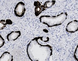 Tissue-Tek Genie<sup>&reg;</sup><br />
anti-Cytokeratin HMW