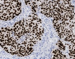 Tissue-Tek Genie<sup>&reg;</sup> anti-Thyroid<br />
Transcription Factor-1
