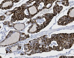 Tissue-Tek Genie<sup>&reg;</sup><br />
anti-Cytokeratin 19