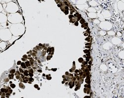 Tissue-Tek Genie<sup>&reg;</sup><br />
anti-Calretinin