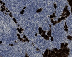 Tissue-Tek Genie<sup>&reg;</sup><br />
anti-ALK (Heme)