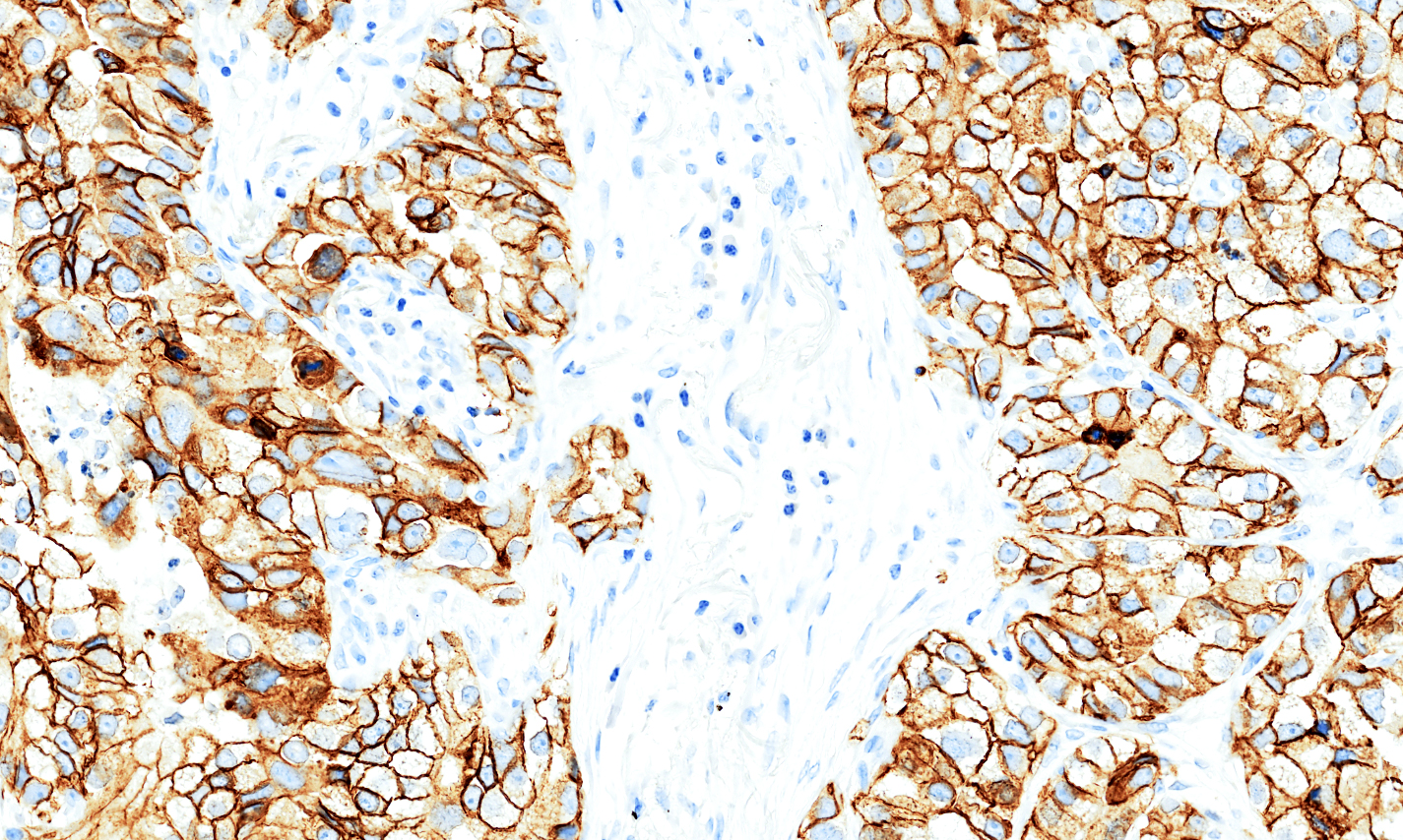 EpCAM-3-(1).jpg