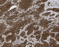 Tissue-Tek Genie<sup>&reg;</sup><br />
anti-Napsin A