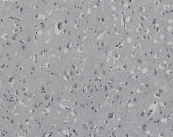 Tissue-Tek Genie<sup>&reg;</sup><br />
DUO Non-immune Mouse and Rabbit Ig Antibody Cocktail, Negative Control