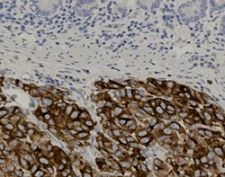 Tissue-Tek Genie<sup>&reg;</sup><br />
anti-Melanosome