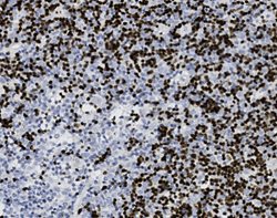Tissue-Tek Genie<sup>&reg;</sup><br />
anti-Terminal Deoxyribonucleotidyl Transferase
