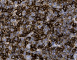 Tissue-Tek Genie<sup>&reg;</sup><br />
anti-CD5