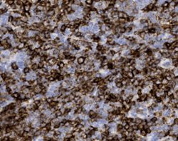 Tissue-Tek Genie<sup>&reg;</sup><br />
anti-CD23