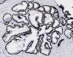 Tissue-Tek Genie<sup>&reg;</sup><br />
anti-Cytokeratin 5/6