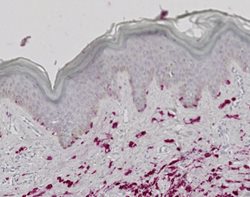 Tissue-Tek Genie<sup>&reg;</sup><br />
anti-Melanoma Pan Antibody Cocktail [HMB45/EP43/T311]