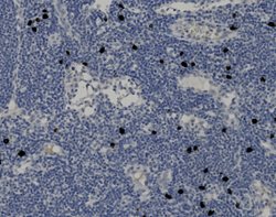 Tissue-Tek Genie<sup>&reg;</sup><br />
anti-IgG4