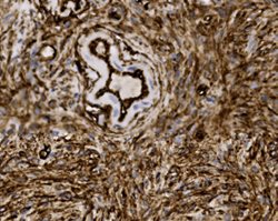 Tissue-Tek Genie<sup>&reg;</sup><br />
anti-CD34