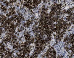 Tissue-Tek Genie<sup>&reg;</sup><br />
anti-CD19