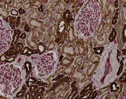 Tissue-Tek Genie<sup>&reg;</sup> DUO<br />
anti-Pan Cytokeratin/CD31 Antibody Cocktail