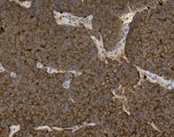 Tissue-Tek Genie<sup>&reg;</sup><br />
anti-Neuron&nbsp;Specific Enolase