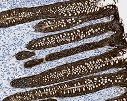 Tissue-Tek Genie<sup>&reg;</sup><br />
anti-Epithelial Cell Adhesion Molecule