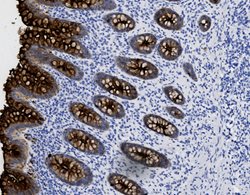 Tissue-Tek Genie<sup>&reg;</sup><br />
anti-CEA