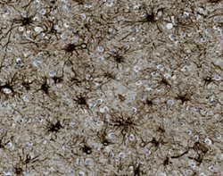 Tissue-Tek Genie<sup>&reg;</sup><br />
anti-Glial Fibrillary&nbsp;Acidic Protein (GFAP)
